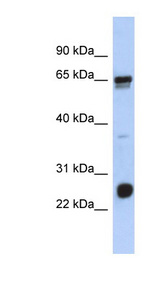 LRIF1 / RIF1 Antibody - LRIF1 / C1orf103 antibody Western blot of Placenta lysate. This image was taken for the unconjugated form of this product. Other forms have not been tested.