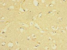 LRIG1 Antibody - Immunohistochemistry of paraffin-embedded human brain tissue at dilution 1:100