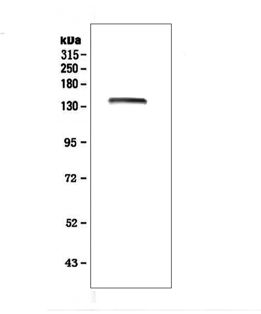 LRIG1 Antibody - Western blot analysis of LRIG1 using anti-LRIG1 antibody. Electrophoresis was performed on a 5-20% SDS-PAGE gel at 70V (Stacking gel) / 90V (Resolving gel) for 2-3 hours. The sample well of each lane was loaded with 50ug of sample under reducing conditions. Lane 1: human Caco-2 whole cell lysate. After Electrophoresis, proteins were transferred to a Nitrocellulose membrane at 150mA for 50-90 minutes. Blocked the membrane with 5% Non-fat Milk/ TBS for 1.5 hour at RT. The membrane was incubated with rabbit anti-LRIG1 antigen affinity purified polyclonal antibody at 0.5 µg/mL overnight at 4°C, then washed with TBS-0.1% Tween 3 times with 5 minutes each and probed with a goat anti-rabbit IgG-HRP secondary antibody at a dilution of 1:10000 for 1.5 hour at RT. The signal is developed using an Enhanced Chemiluminescent detection (ECL) kit with Tanon 5200 system. A specific band was detected for LRIG1 at approximately 145KD. The expected band size for LRIG1 is at 119KD.