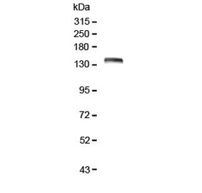 LRIG1 Antibody - Western blot testing of human Caco-2 lysate with LRIG1 antibody at 0.5ug/ml. Expected molecular weight: 119-145 kDa depending on glycosylation level. Soluble fragments of 90-105 kDa and 60-70 kDa may also be observed.