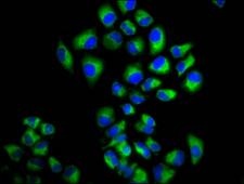 LRIG2 Antibody - Immunofluorescence staining of Hela cells diluted at 1:166, counter-stained with DAPI. The cells were fixed in 4% formaldehyde, permeabilized using 0.2% Triton X-100 and blocked in 10% normal Goat Serum. The cells were then incubated with the antibody overnight at 4°C.The Secondary antibody was Alexa Fluor 488-congugated AffiniPure Goat Anti-Rabbit IgG (H+L).