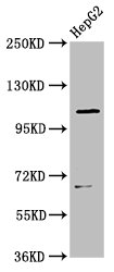 LRIG2 Antibody - Western Blot Positive WB detected in: HepG2 whole cell lysate All Lanes: LRIG2 antibody at 3.5µg/ml Secondary Goat polyclonal to rabbit IgG at 1/50000 dilution Predicted band size: 119 KDa Observed band size: 119 KDa