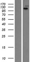 LRIG2 Protein - Western validation with an anti-DDK antibody * L: Control HEK293 lysate R: Over-expression lysate