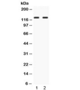 LRIG3 Antibody - Western blot testing of 1) rat testis and 2) human HepG2 lysate with LRIG3 antibody at 0.5ug/ml. Observed molecular weight: ~123 kDa (precursor), 140-170 kDa (glycosylated).