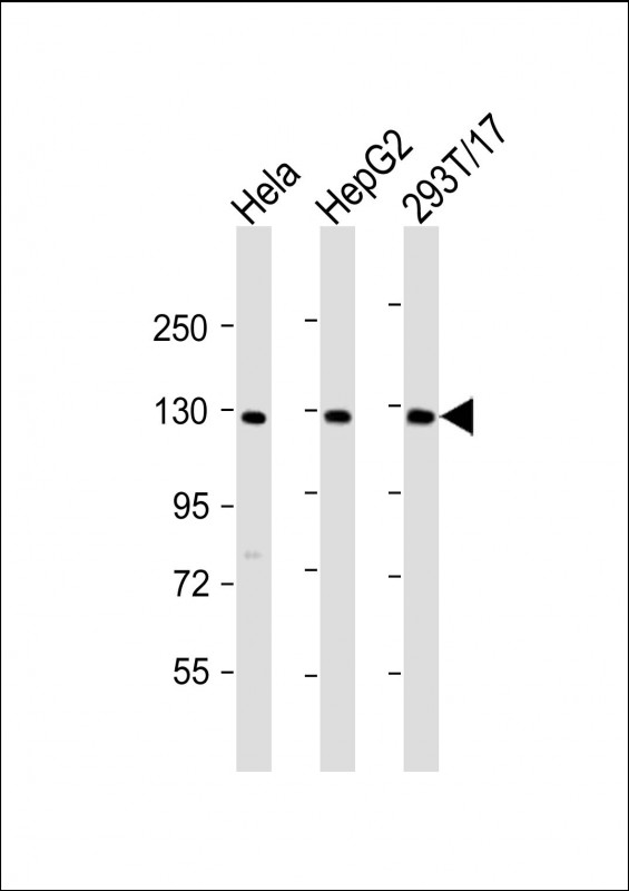 LRIG3 Antibody - All lanes: Anti-LRIG3 Antibody (N-Term) at 1:2000 dilution Lane 1: Hela whole cell lysate Lane 2: HepG2 whole cell lysate Lane 3: 293T/17 whole cell lysate Lysates/proteins at 20 µg per lane. Secondary Goat Anti-Rabbit IgG, (H+L), Peroxidase conjugated at 1/10000 dilution. Predicted band size: 123 kDa Blocking/Dilution buffer: 5% NFDM/TBST.