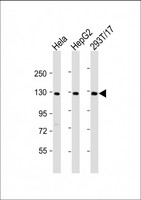 LRIG3 Antibody - All lanes: Anti-LRIG3 Antibody (N-Term) at 1:2000 dilution Lane 1: Hela whole cell lysate Lane 2: HepG2 whole cell lysate Lane 3: 293T/17 whole cell lysate Lysates/proteins at 20 µg per lane. Secondary Goat Anti-Rabbit IgG, (H+L), Peroxidase conjugated at 1/10000 dilution. Predicted band size: 123 kDa Blocking/Dilution buffer: 5% NFDM/TBST.