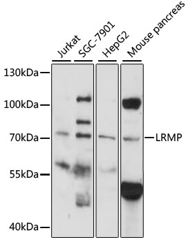 LRMP / JAW1 Antibody - Western blot analysis of extracts of various cell lines, using LRMP antibody at 1:1000 dilution. The secondary antibody used was an HRP Goat Anti-Rabbit IgG (H+L) at 1:10000 dilution. Lysates were loaded 25ug per lane and 3% nonfat dry milk in TBST was used for blocking. An ECL Kit was used for detection and the exposure time was 90s.