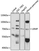 LRMP / JAW1 Antibody - Western blot analysis of extracts of various cell lines, using LRMP antibody at 1:1000 dilution. The secondary antibody used was an HRP Goat Anti-Rabbit IgG (H+L) at 1:10000 dilution. Lysates were loaded 25ug per lane and 3% nonfat dry milk in TBST was used for blocking. An ECL Kit was used for detection and the exposure time was 90s.