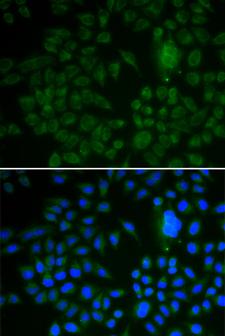 LRP1 / CD91 Antibody - Immunofluorescence analysis of U2OS cells.