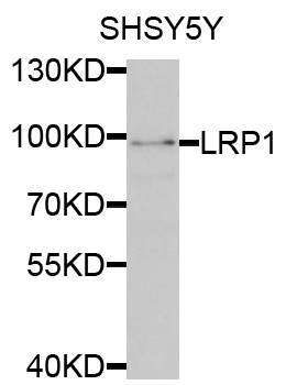 LRP1 / CD91 Antibody - Western blot analysis of extracts of SH-SY5Y cells, using LRP1 antibody at 1:1000 dilution. The secondary antibody used was an HRP Goat Anti-Rabbit IgG (H+L) at 1:10000 dilution. Lysates were loaded 25ug per lane and 3% nonfat dry milk in TBST was used for blocking. An ECL Kit was used for detection and the exposure time was 90s.