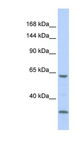 LRP1 / CD91 Antibody - LRP1 / CD91 antibody Western blot of 721_B cell lysate. This image was taken for the unconjugated form of this product. Other forms have not been tested.