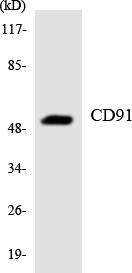 LRP1 / CD91 Antibody - Western blot analysis of the lysates from HUVECcells using CD91 antibody.