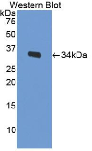LRP1 / CD91 Antibody - Western blot of recombinant LRP1 / CD91.