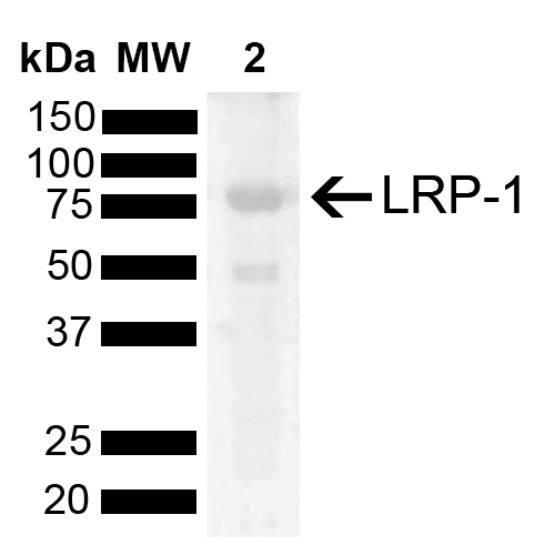 LRP1 / CD91 Antibody - Western blot analysis of Rat Kidney showing detection of 504.6 kDa LRP-1 protein using Rabbit Anti-LRP-1 Polyclonal Antibody. Lane 1: Molecular Weight Ladder (MW). Lane 2: Rat Kidney. Load: 15 µg. Block: 5% Skim Milk powder in TBST. Primary Antibody: Rabbit Anti-LRP-1 Polyclonal Antibody  at 1:1000 for 2 hours at RT with shaking. Secondary Antibody: Goat Anti-Rabbit IgG: HRP at 1:5000 for 1 hour at RT. Color Development: ECL solution for 5 min at RT. Predicted/Observed Size: 504.6 kDa. Other Band(s): 80 kDa, 50 kDa.