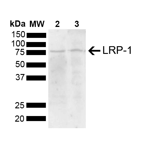 LRP1 / CD91 Antibody - Western blot analysis of Mouse, Rat Brain showing detection of 504.6 kDa LRP-1 protein using Rabbit Anti-LRP-1 Polyclonal Antibody. Lane 1: Molecular Weight Ladder (MW). Lane 2: Mouse Brain. Lane 3: Rat Brain. Load: 15 µg. Block: 5% Skim Milk powder in TBST. Primary Antibody: Rabbit Anti-LRP-1 Polyclonal Antibody  at 1:1000 for 2 hours at RT with shaking. Secondary Antibody: Goat Anti-Rabbit IgG: HRP at 1:5000 for 1 hour at RT. Color Development: ECL solution for 5 min at RT. Predicted/Observed Size: 504.6 kDa. Other Band(s): 80 kDa.