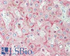 LRP1 / CD91 Antibody - Anti-LRP1 / CD91 antibody IHC staining of human liver. Immunohistochemistry of formalin-fixed, paraffin-embedded tissue after heat-induced antigen retrieval.