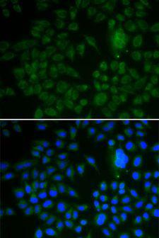 LRP1 / CD91 Antibody - Immunofluorescence analysis of U2OS cells using LRP1 antibody. Blue: DAPI for nuclear staining.