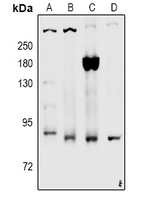 LRP1 / CD91 Antibody - Western blot analysis of CD91 (pS4520) expression in rat brain (A), C6 (B), LO2 (C), HEK293T (D) whole cell lysates.