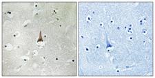 LRP10 Antibody - Immunohistochemistry analysis of paraffin-embedded human brain tissue, using LRP10 Antibody. The picture on the right is blocked with the synthesized peptide.