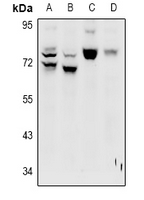 LRP10 Antibody - Western blot analysis of LRP10 expression in HepG2 (A), A549 (B), PC12 (C), CT26 (D) whole cell lysates.