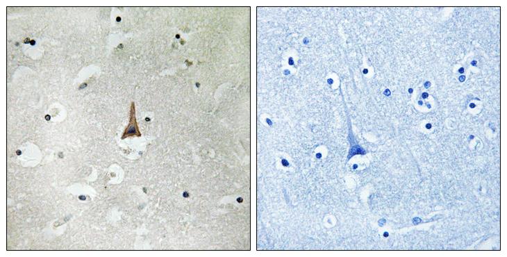 LRP10 Antibody - Peptide - + Immunohistochemistry analysis of paraffin-embedded human brain tissue using LRP10 antibody.