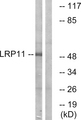 LRP11 Antibody - Western blot analysis of lysates from Jurkat cells, using LRP11 Antibody. The lane on the right is blocked with the synthesized peptide.