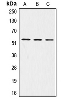 LRP11 Antibody - Western blot analysis of LRP11 expression in A431 (A); HepG2 (B); Jurkat (C) whole cell lysates.