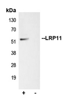 LRP11 Antibody - Immunoprecipitation of LRP11 from 0.5mg Jurkat whole cell extract lysate using 5ug of Anti-LRP11 Antibody and 50ul of protein G magnetic beads (+). No antibody was added to the control (-). The antibody was incubated under agitation with Protein G beads for 10min Jurkat whole cell extract lysate diluted in RIPA buffer was added to each sample and incubated for a further 10min under agitation. Proteins were eluted by addition of 40ul SDS loading buffer and incubated for 10min at 70 C; 10ul of each sample was separated on a SDS PAGE gel transferred to a nitrocellulose membrane blocked with 5% BSA and probed with Anti-LRP11 Antibody.