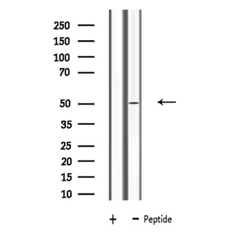 LRP11 Antibody - Western blot analysis of extracts of Jurkat cells using LRP11 antibody.