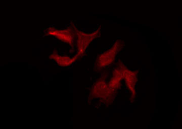 LRP11 Antibody - Staining HeLa cells by IF/ICC. The samples were fixed with PFA and permeabilized in 0.1% Triton X-100, then blocked in 10% serum for 45 min at 25°C. The primary antibody was diluted at 1:200 and incubated with the sample for 1 hour at 37°C. An Alexa Fluor 594 conjugated goat anti-rabbit IgG (H+L) Ab, diluted at 1/600, was used as the secondary antibody.