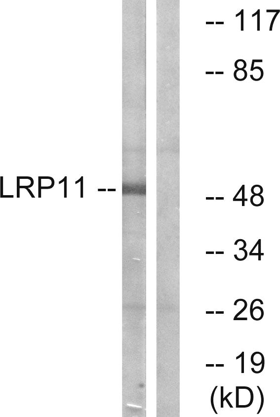 LRP11 Antibody - Western blot analysis of extracts from Jurkat cells, using LRP11 antibody.