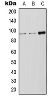 LRP12 Antibody - Western blot analysis of LRP12 expression in Jurkat (A); HeLa (B); SP2/0 (C) whole cell lysates.