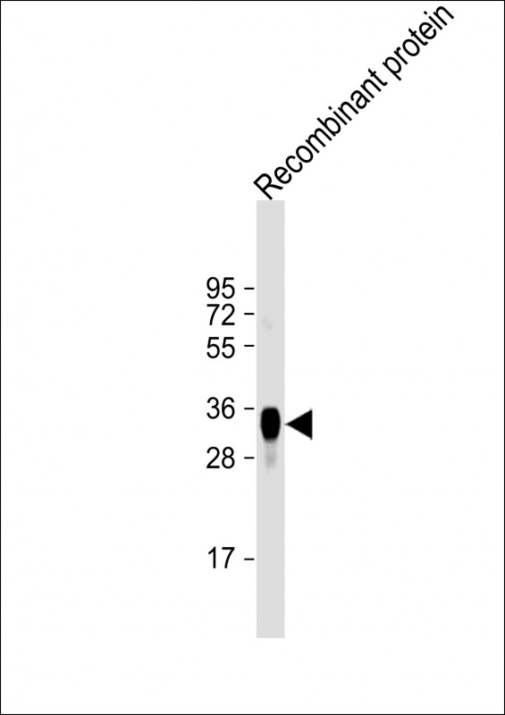 LRP1B Antibody - Anti-LRP1B Antibody at 1:2000 dilution + Recombinant protein Lysates/proteins at 20 µg per lane. Secondary Goat Anti-mouse IgG, (H+L), Peroxidase conjugated at 1/10000 dilution. Predicted band size: 515 kDa Blocking/Dilution buffer: 5% NFDM/TBST.