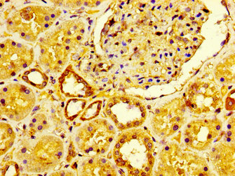 LRP2 / Megalin Antibody - Immunohistochemistry image at a dilution of 1:600 and staining in paraffin-embedded human kidney tissue performed on a Leica BondTM system. After dewaxing and hydration, antigen retrieval was mediated by high pressure in a citrate buffer (pH 6.0) . Section was blocked with 10% normal goat serum 30min at RT. Then primary antibody (1% BSA) was incubated at 4 °C overnight. The primary is detected by a biotinylated secondary antibody and visualized using an HRP conjugated SP system.