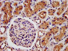 LRP2 / Megalin Antibody - Immunohistochemistry image at a dilution of 1:500 and staining in paraffin-embedded human kidney tissue performed on a Leica BondTM system.