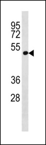 LRP2BP / LRP2 Binding Protein Antibody - LRP2BP Antibody western blot of A549 cell line lysates (35 ug/lane). The LRP2BP antibody detected the LRP2BP protein (arrow).