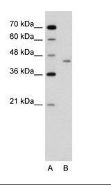 LRP2BP / LRP2 Binding Protein Antibody - A: Marker, B: Jurkat Cell Lysate.  This image was taken for the unconjugated form of this product. Other forms have not been tested.