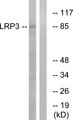 LRP3 Antibody - Western blot analysis of lysates from RAW264.7 cells, using LRP3 Antibody. The lane on the right is blocked with the synthesized peptide.
