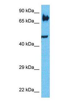 LRP3 Antibody - Western blot of LRP3 Antibody with human PANC1 Whole Cell lysate.  This image was taken for the unconjugated form of this product. Other forms have not been tested.