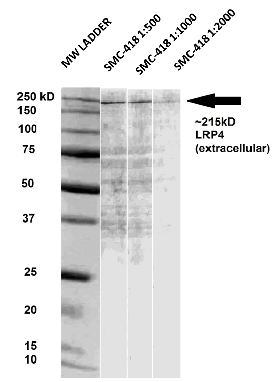 LRP4 Antibody - Western blot of rat brain membrane lysates showing the detection of ~215 kDa LRP4 protein using Anti-LRP4 antibody [S207-27] (LRP4 antibody). Lane 1: MW ladder. Lane 2: Anti-LRP4 (1:500). Lane 3: Anti-LRP4 (1:1000). Lane 4: Anti-LRP4 (1:2000). Load: 33 ug RBM per lane. Block: 5% milk + TBST O/N at 4°C. Primary antibody: Mouse Anti-LRP4 antibody [S207-27] (LRP4 antibody) at 1:500,1:1000 1:2000 dilution in TBS for 60 min at RT.  This image was taken for the unconjugated form of this product. Other forms have not been tested.