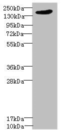 LRP4 Antibody - Western blot All Lanes: LRP4 antibody IgG at 1.39ug/ml+ PC-3 whole cell lysate Secondary Goat polyclonal to rabbit IgG at 1/10000 dilution Predicted band size: 212 kDa Observed band size: 212 kDa