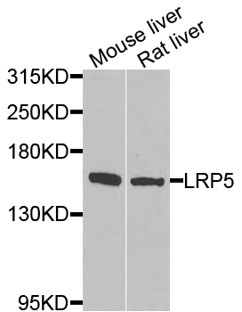 LRP5 Antibody - Western blot analysis of extracts of various cell lines, using LRP5 antibody at 1:1000 dilution. The secondary antibody used was an HRP Goat Anti-Rabbit IgG (H+L) at 1:10000 dilution. Lysates were loaded 25ug per lane and 3% nonfat dry milk in TBST was used for blocking. An ECL Kit was used for detection and the exposure time was 90s.