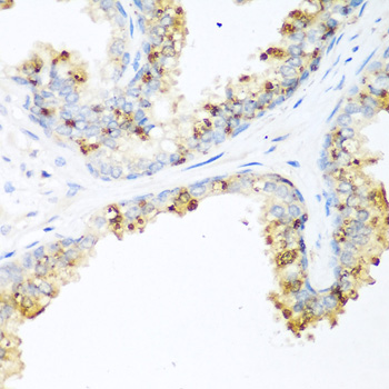 LRP5 Antibody - Immunohistochemistry of paraffin-embedded human prostate using LRP5 antibodyat dilution of 1:200 (40x lens).