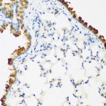 LRP5 Antibody - Immunohistochemistry of paraffin-embedded mouse lung using LRP5 antibodyat dilution of 1:200 (40x lens).