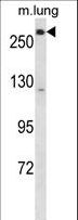 LRP5 Antibody - LRP5 Antibody western blot of mouse lung tissue lysates (35 ug/lane). The LRP5 antibody detected the LRP5 protein (arrow).