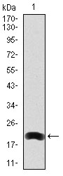 LRP5 Antibody - Western blot using LRP5 monoclonal antibody against human LRP5 (AA: 1422-1615) recombinant protein. (Expected MW is 20.8 kDa)
