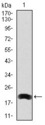 LRP5 Antibody - Western blot using LRP5 monoclonal antibody against human LRP5 (AA: 1422-1615) recombinant protein. (Expected MW is 20.8 kDa)
