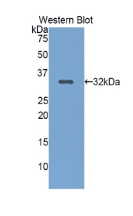 LRP5 Antibody - Western blot of recombinant LRP5.  This image was taken for the unconjugated form of this product. Other forms have not been tested.