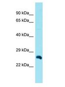 LRP5L Antibody - LRP5L antibody Western Blot of Fetal Heart. Antibody dilution: 1 ug/ml.  This image was taken for the unconjugated form of this product. Other forms have not been tested.