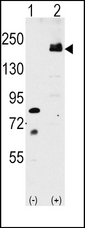 LRP6 Antibody - Western blot of LRP6 (arrow) using rabbit polyclonal LRP6 Antibody (C-term T1546). 293 cell lysates (2 ug/lane) either nontransfected (Lane 1) or transiently transfected with the LRP6 gene (Lane 2) (Origene Technologies).